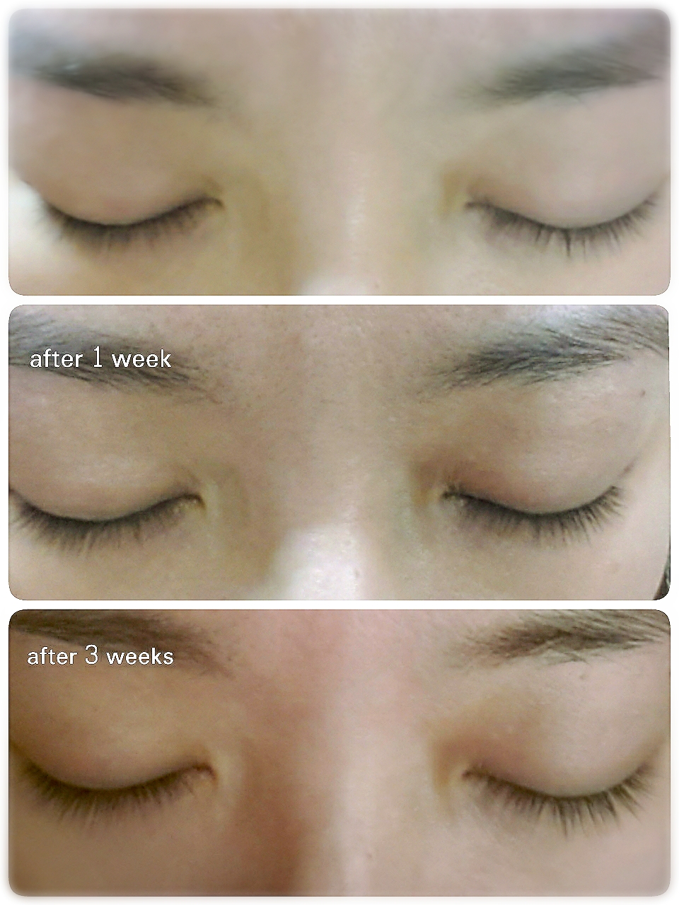 Shiseido Adenovital Eyelash Serum 6g เซรั่มบำรุงขนตา ให้ขนตายาว และแข็งแรง ไม่หลุดร่วงง่าย และบำรุงให้ขนตาที่หลุดมีการขึ้นใหม่อย่างต่อเนื่อง
