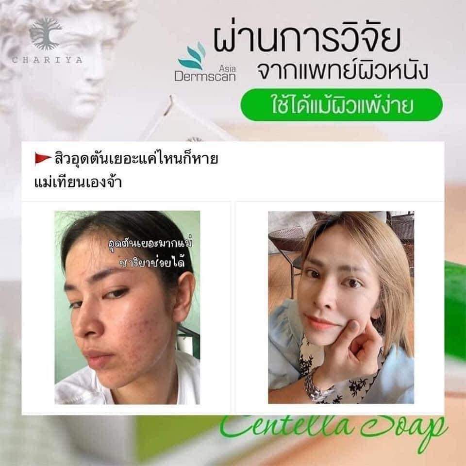 สบู่ใบบัวบก ชาริยา ของแท้ 100% แถม!! ต่าข่ายตีฟอง ฟรีเก็บเงินปลายทาง