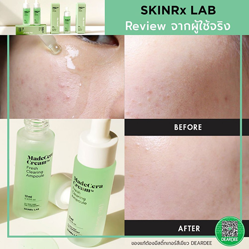 (ขวดเขียว) SKINRx LAB MadeCera Cream Fresh Clearing Ampoule 13mL เซรั่มบำรุงผิวหน้า ซึมไว ไม่เหนอะหนะ