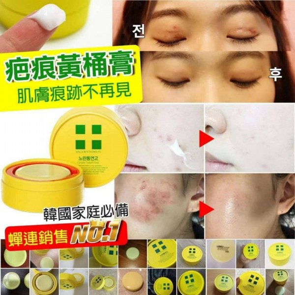 Yellow Ointment Centella Treated Extract 18g ครีมดูแลแผลเป็นและรอยสิว ที่ รพ.เกาหลีนิยมมากๆ พร้อมช่วยเรื่องรูขุมขนกระชับ ผิวละเอียด เรียบเนียน