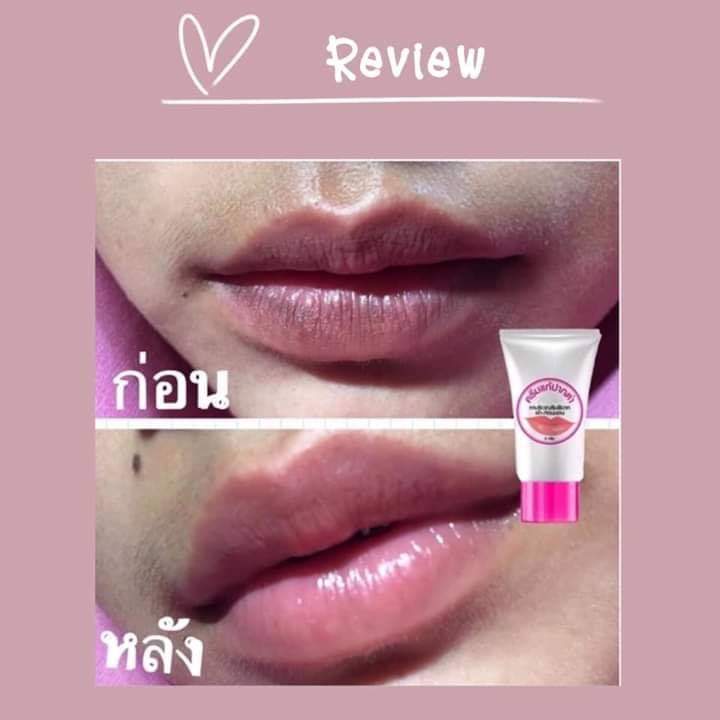 ครีมแก้ปากดำ คลินิค ลิปแก้ปากดำ