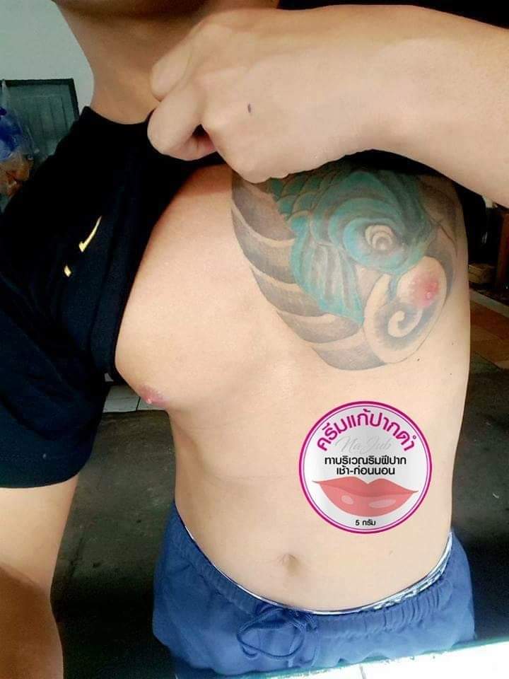 ครีมแก้ปากดำ คลินิค ลิปแก้ปากดำ