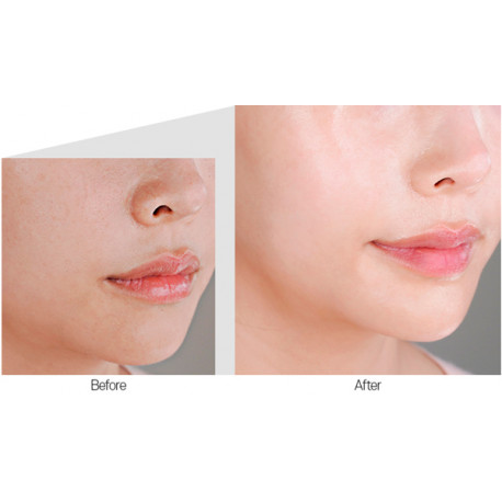 Medi-Peel Cell Toxing Dermajours Ampoule 100mL เมดิพีล เซรั่มให้ความความชุ่มชื้น ปรับสีผิว ลดริ้วรอย เสริมเกราะป้องกันผิว ด้วยเทคนิค Liposomal ดันเซรั่มลงผิวชั้นลึก บำรุงได้อย่างมีประสิทธิภาพ