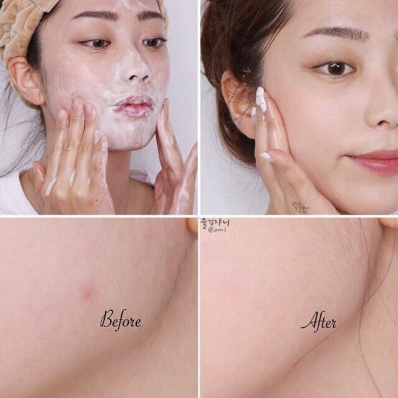 (ลอตใหม่ Exp 2025) Innisfree Bija Trouble Facial Foam 150mL คลีนซิ่งโฟมเนื้อเนียนนุ่ม ช่วยทำความสะอาดใบหน้าได้อย่างหมดจด และปลอบประโลมผิวสำหรับผู้ที่มีปัญหาสิว