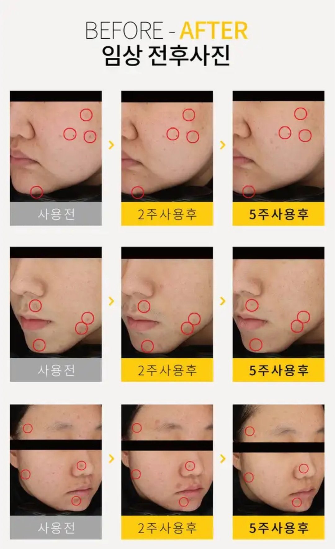 Tisha AC7 Spot Serum 15g เจลเซรั่มสำหรับแต้มสิวตัวดัง จากเกาหลี จัดการปัญหาสิวได้อย่างตรงจุด