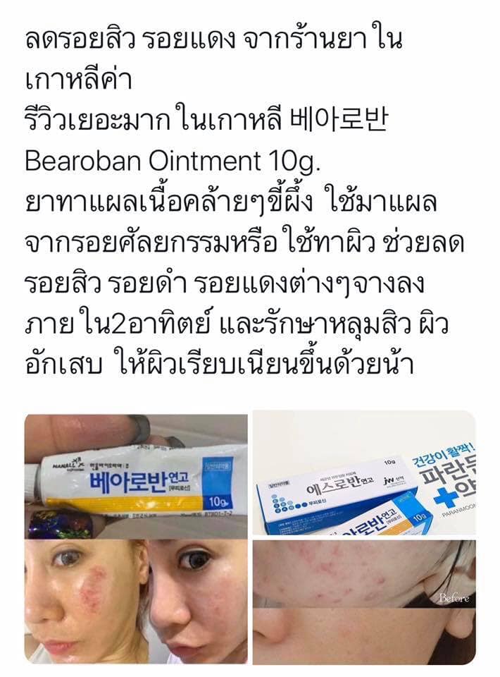 ขายส่ง 75.-/80.-(พร้อมส่ง) Bearoban Ointment 10g ครีมทาแผลเป็นตัวดังจากเกาหลี ช่วยสมานแผล ลดรอยสิว รอยแผลเป็น รอยแผลศัลยกรรมจางได้อย่างดี รีวิวเพียบเพราะหมอศัลย์ที่เกาหลีแนะนำค่ะ