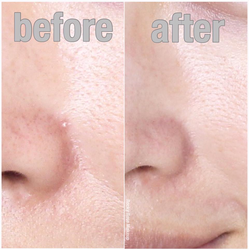 (ลดพิเศษ 35%) Kiehl's Blue Herbal Spot Treatment 15mL ทรีตเม้นต์เฉพาะจุดเพื่อฟื้นบำรุงตำแหน่งที่เกิดสิว สูตรผสมอันเชี่ยวชาญนี้ซึมซาบสู่ผิวเพื่อฟื้นบำรุงตำแหน่งที่เกิดสิวโดยเฉพาะ