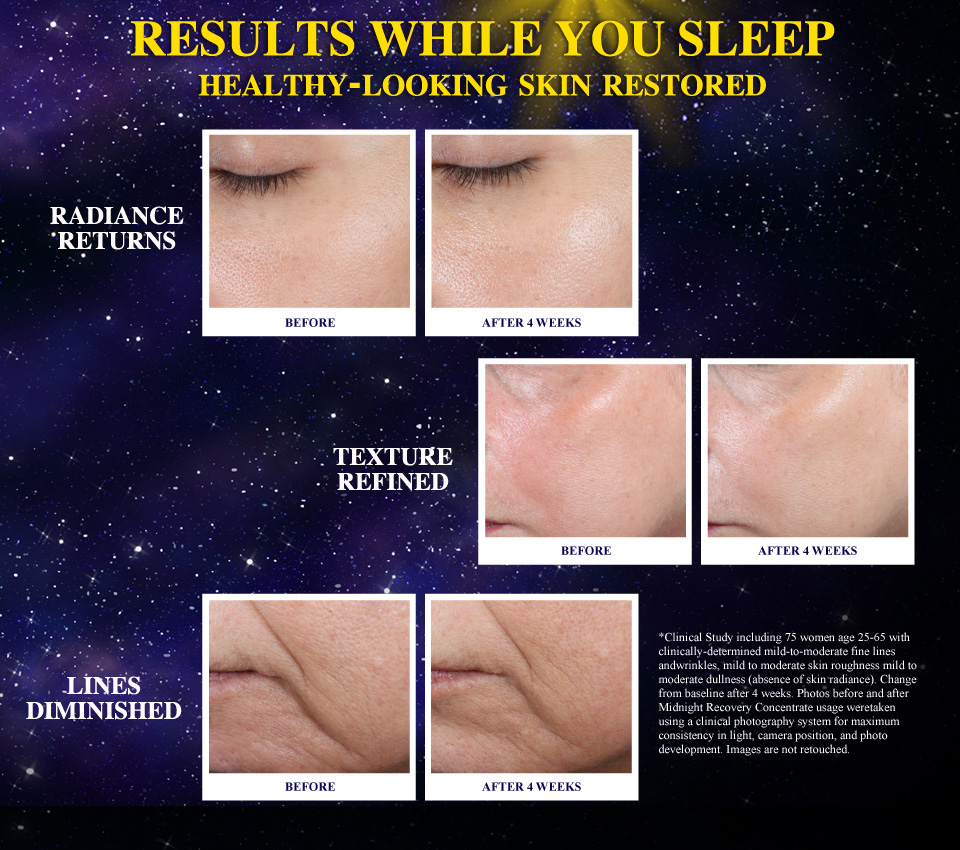 (Tester) Kiehl's Midnight Recovery Concentrate 4 mL มหัศจรรย์แห่งการดูแลผิวยามค่ำคืน เพิ่มความอ่อนเยาว์ นุ่ม เนียนใสอย่างชัดเจน