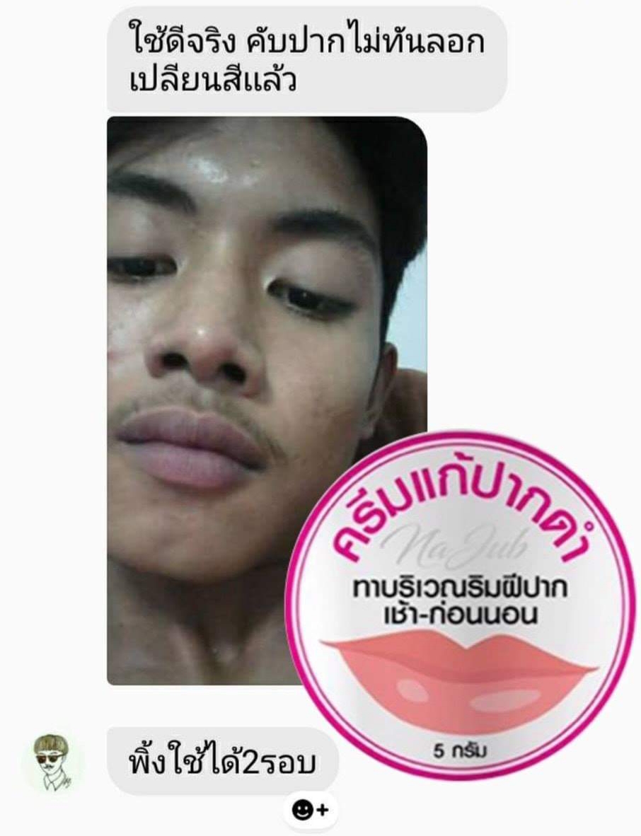 ครีมแก้ปากดำ คลินิค ลิปแก้ปากดำ