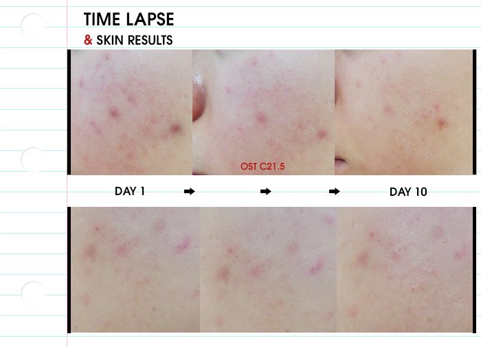 (พร้อมส่ง ฉลากไทย) Dear Klairs Freshly Juiced Vitamin Drop 35mL เซรั่มวิตามินซีบริสุทธิ์ by Ecovit