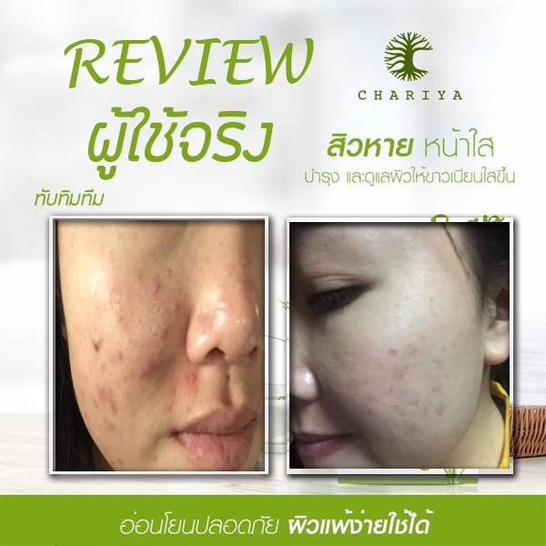 สบู่ใบบัวบก ชาริยา ของแท้ 100% แถม!! ต่าข่ายตีฟอง ฟรีเก็บเงินปลายทาง