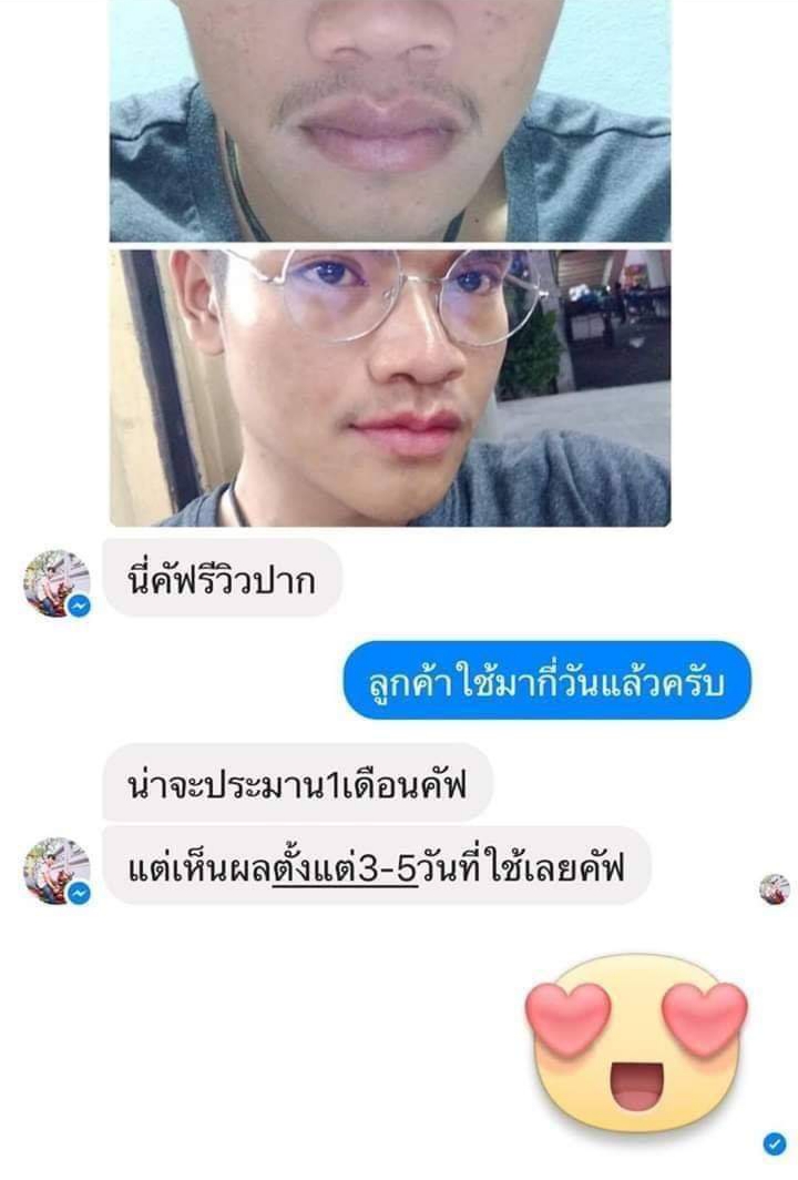 ครีมแก้ปากดำ คลินิค ลิปแก้ปากดำ