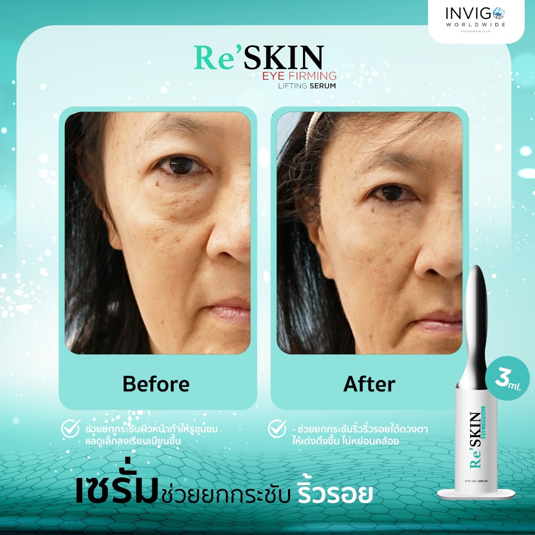 รีวิว ReSKIN Invigo รีสกิน เซรั่ม ยกกระชับ ลดริ้วรอย ถุงใต้ตา จาก อินวีโก้