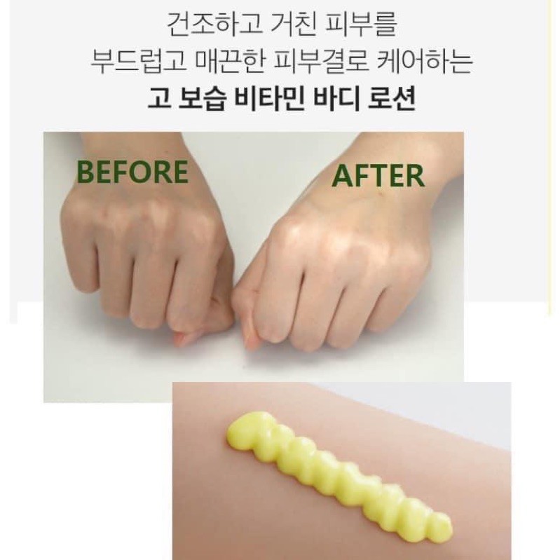 Medi-Peel Vitamin Body Lotion 400mL เมดิพีล โลชั่นบำรุงผิวกาย อุดมด้วยวิตามินซี ช่วยบำรุงให้ผิวกายกระจ่างใสทั่วทั้งตัว ช่วยให้รอยสิวตามลำตัว รอยสิวที่หลังดูจางลง ผิวสม่ำเสมอ เนียนกระชับ