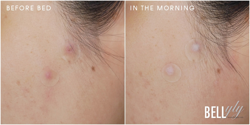 (ฉลากไทย) Cosrx Acne Pimple Master Patch 24 ชิ้น (3 ขนาด) คอสอาร์เอ๊กซ์ แผ่นแปะสิวที่หลายๆ คนรีิวิวกันว่าเริ่ด แผ่นแปะปิดแน่นสนิท มี 3 ขนาดให้เลือกใช้ ช่วยดูดซับของเหลว ที่อักเสบใต้ผิวหนัง ลดโอกาสการสัมผัสจากภายนอกจึงลดโอกาสการติดเชื้อ