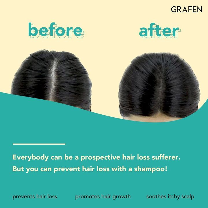 พร้อมส่ง Grafen Root Booster Shampoo 500mL แชมพูผมร่วง แชมพูเกาหลี อุดมด้วยสารสกัด 9 ชนิด จัดการกับปัญหาผมร่วงและรังแคได้อย่างอยู่หมัด สารสกัดจากชาเขียว อุดมไปด้วนสารต้านอนุมูลอิสระ ช่วยผ่อนคลายหนังศีรษะ สารสกัดจากถั่วดำ ช่วยปลอบประโลม และลดอาการอักเสบของ