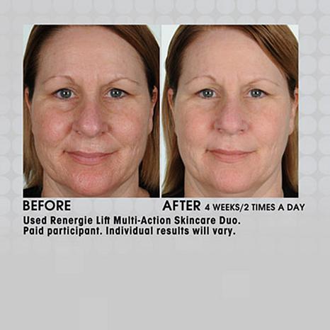 (Tester) Lancome Renergie Lift Multi-Action Reviva-Concentrate 10mL เซรั่มยกระดับความกระชับผิว ฟื้นบำรุงผิวโดยรวมและเห็นผลได้ทันที ด้วย เทคโนโลยี Multi-Tension และ Multi-Vital Complex