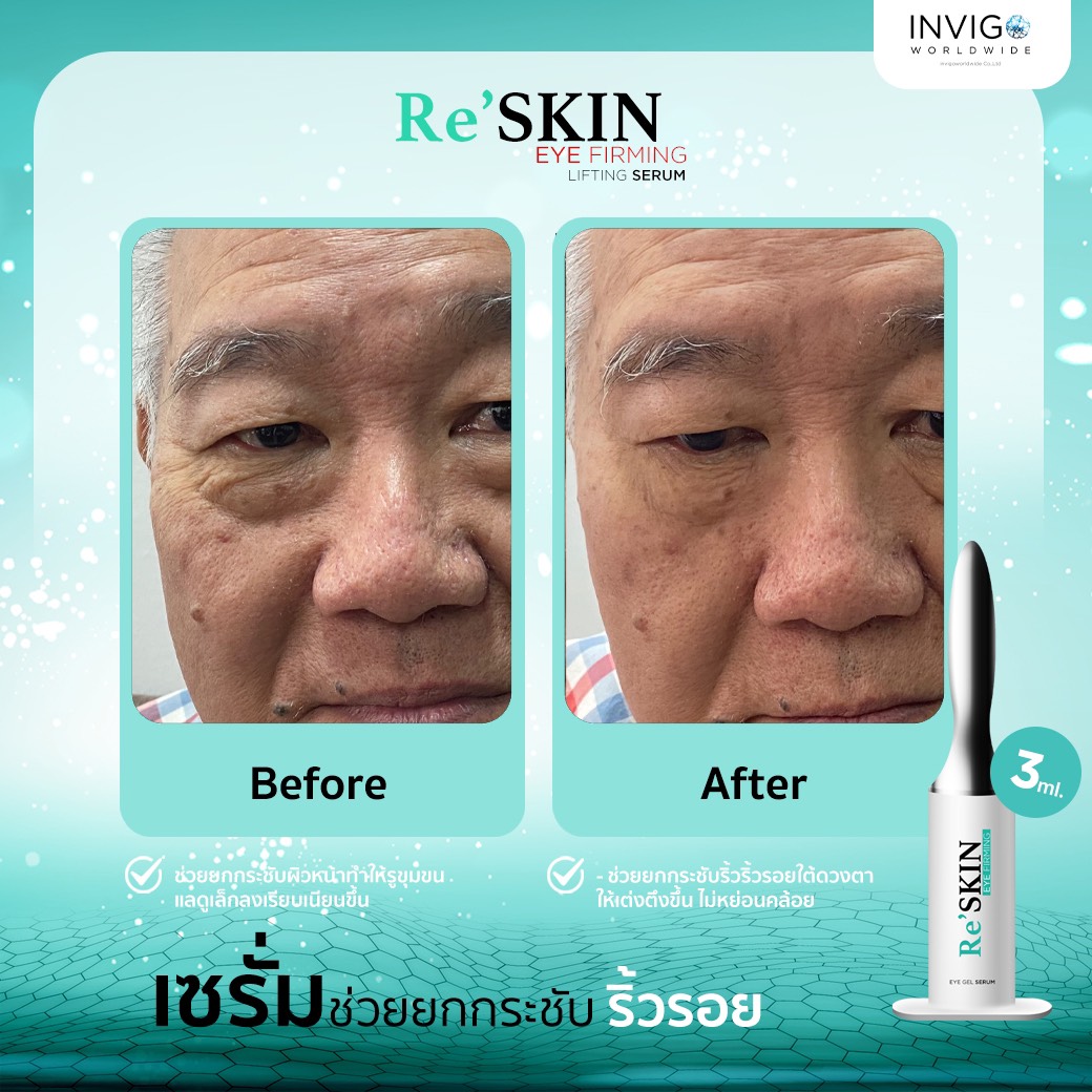 รีวิว ReSKIN Invigo รีสกิน เซรั่ม ยกกระชับ ลดริ้วรอย ถุงใต้ตา จาก อินวีโก้