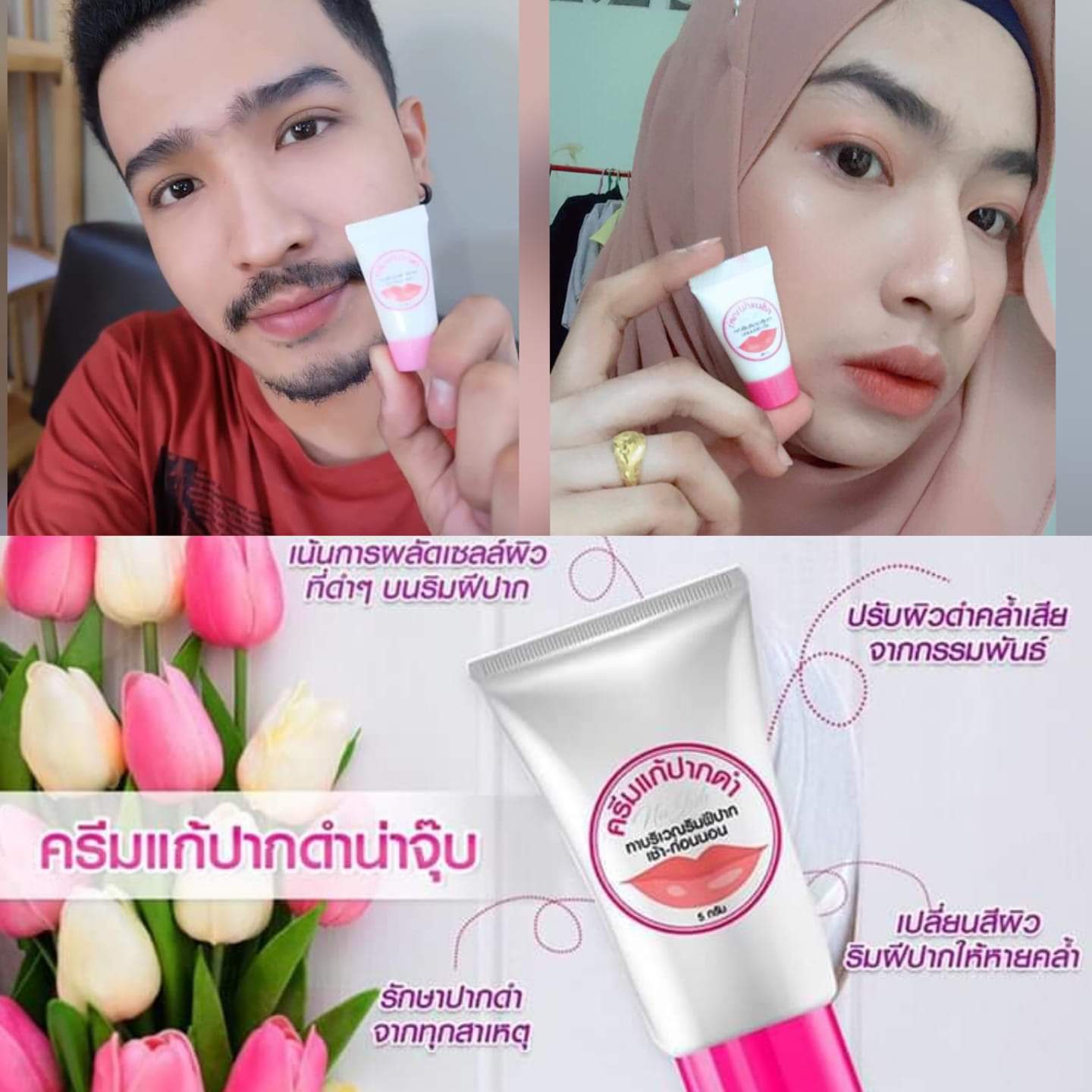 ครีมแก้ปากดำ คลินิค ลิปแก้ปากดำ