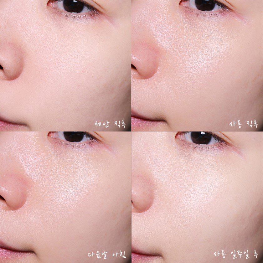 Graymelin Bifida Fermentation Serum 50mL เกรย์เมลิน บิฟิดา เซรั่มคู่แฝด Este ANR จากเกาหลี กู้หน้าแบบเร่งด่วน นอนดึก โต้รุ่ง เครียด ผิวโทรม ต้องตัวนี้เลยค่ะ