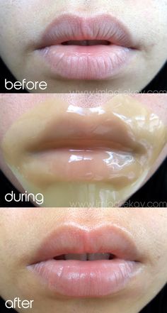 (แพคคู่ x2) Pure Smile Choosy Lip Gel Mask #Peach ลิปเจลมาส์ก ขายดีอันดับ 1 ในญี่ปุ่นและไต้หวัน กลิ่นพีชสีชมพู มาส์กนมให้นุ่มชุ่มชื้นต่อได้ด้วยค่ะ