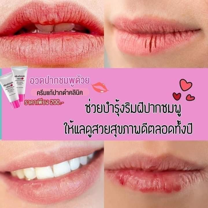 ครีมแก้ปากดำ คลินิค ลิปแก้ปากดำ