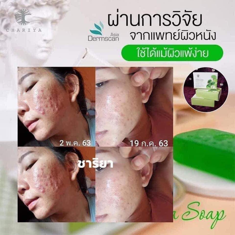 สบู่ใบบัวบก ชาริยา ของแท้ 100% แถม!! ต่าข่ายตีฟอง ฟรีเก็บเงินปลายทาง