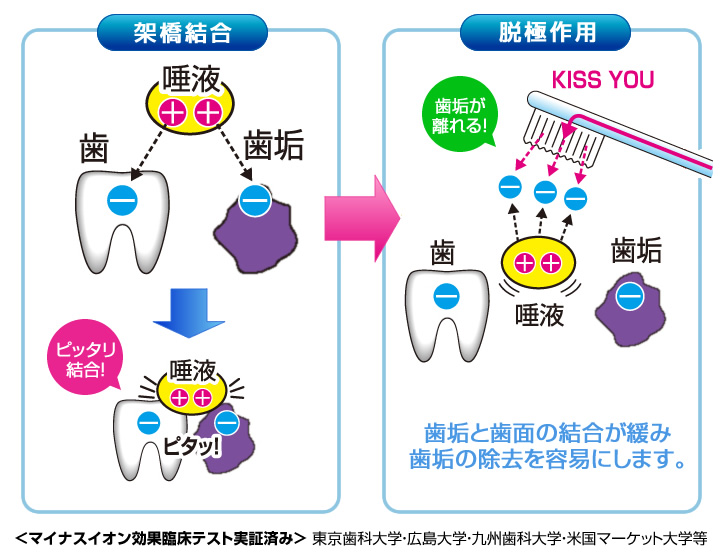 (ขนาดปกติ กล่องเขียว ด้ามสีฟ้า) Kiss You แปรงสีฟัน Ionic จากญี่ปุ่น มีประจุไอออนลบ ช่วยในการขจัดคราบสิ่งสกปรกออกมาได้ดีกว่า ใช้ต่อเนื่องฟันจะขาวขึ้นแม้เป็นคราบชา กาแฟ หรือบุหรี่ กลิ่นปากลดลง คราบหินปูนสะสมยากขึ้นค่ะ