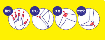 ครีมบำรุงมือและเท้าสำหรับคุณแม่ Shiseido Urea Hands & Feet Cream (100g)