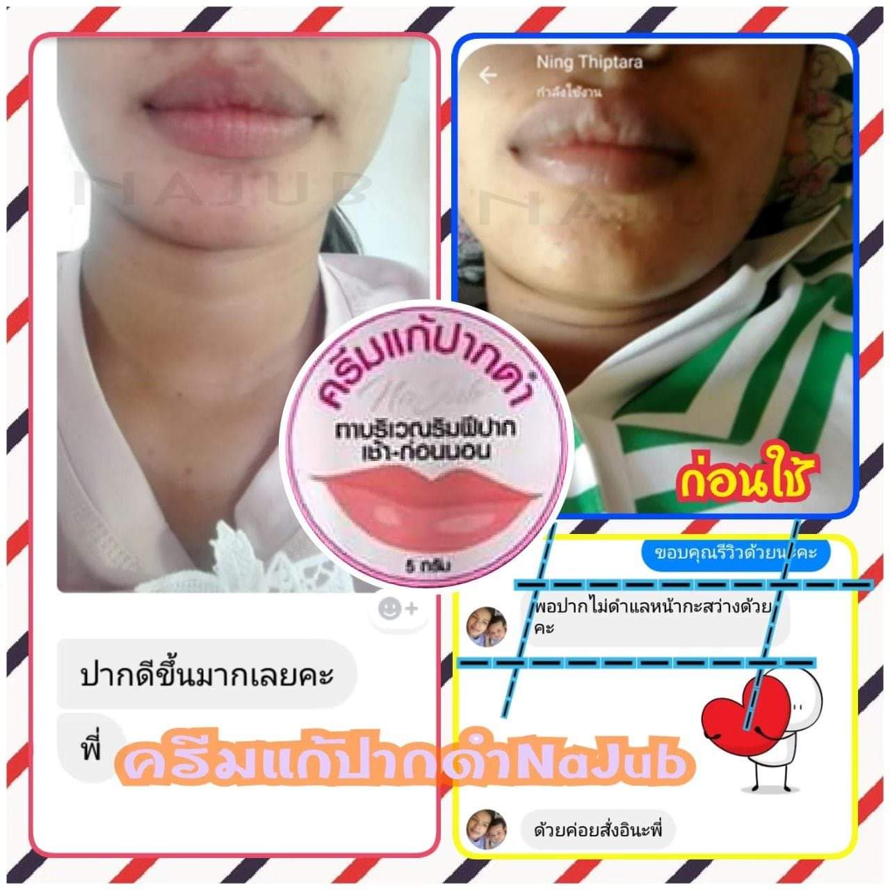 ครีมแก้ปากดำ คลินิค ลิปแก้ปากดำ