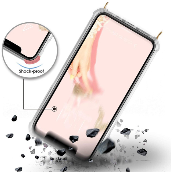 เคสใสไอโฟน พร้อมสายคล้อง เคส iPhone ใช้ ห้อยคอ สะพายข้างได้