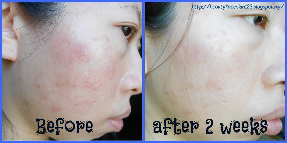 (พร้อมส่ง ฉลากไทย) Dear Klairs Freshly Juiced Vitamin Drop 35mL เซรั่มวิตามินซีบริสุทธิ์ by Ecovit