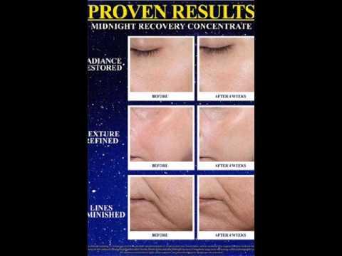 (30mL) Kiehls Midnight Recovery Concentrate 30mL เซรั่มเข้มข้นช่วยบำรุงและเสริมความแข็งแรงให้ผิวในเวลากลางคืน พลังจากธรรมชาติช่วยผิวดูสดใสขึ้นในตอนเช้า