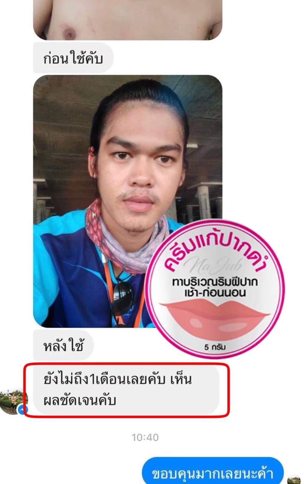 ครีมแก้ปากดำ คลินิค ลิปแก้ปากดำ