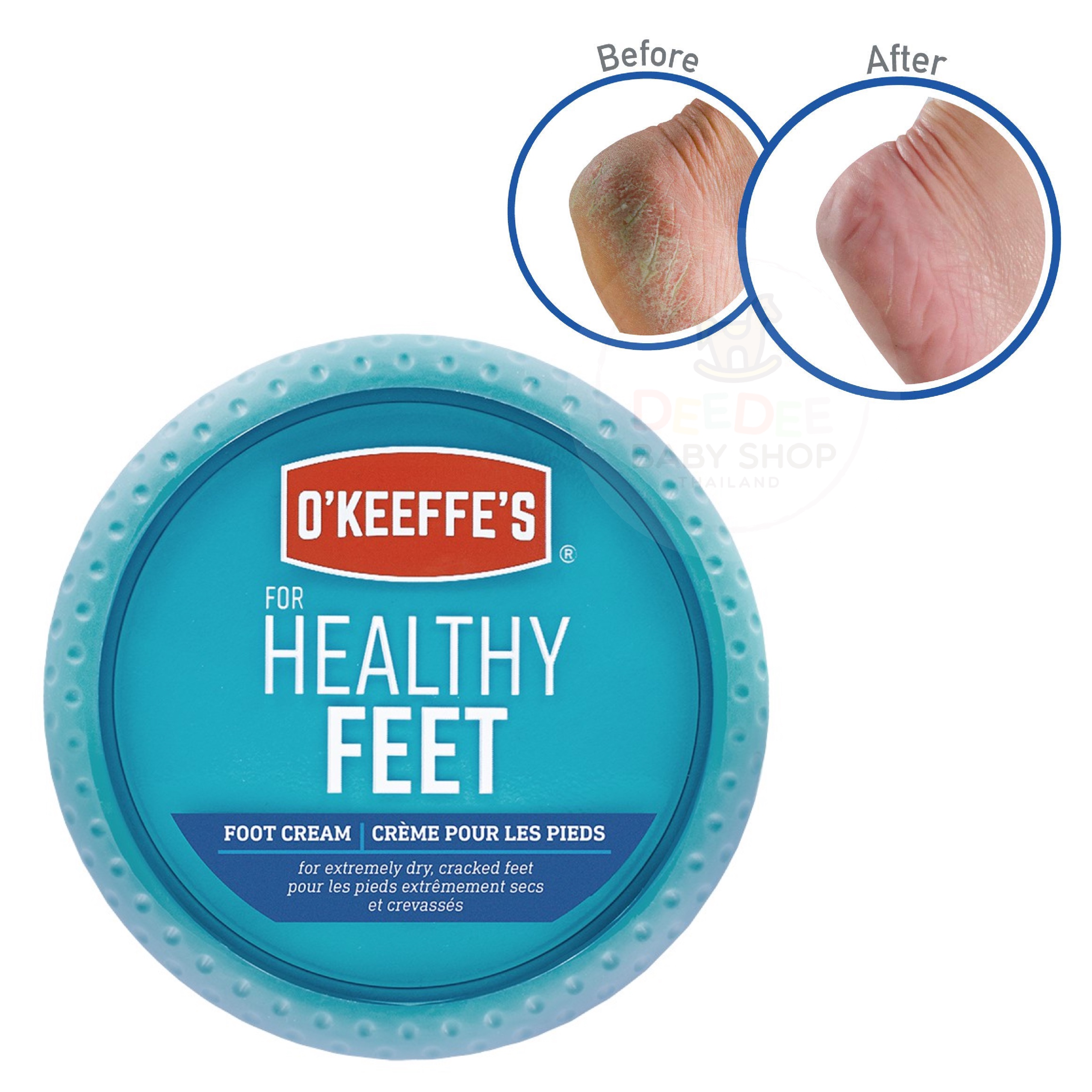 ครีมบรรเทาอาการส้นเท้าแตก O'KEEFFE'S For HEALTHY FEET Foot Cream