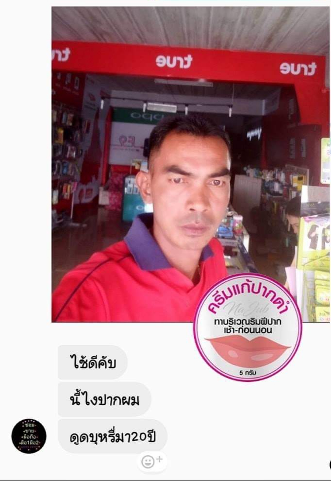 ครีมแก้ปากดำ คลินิค ลิปแก้ปากดำ