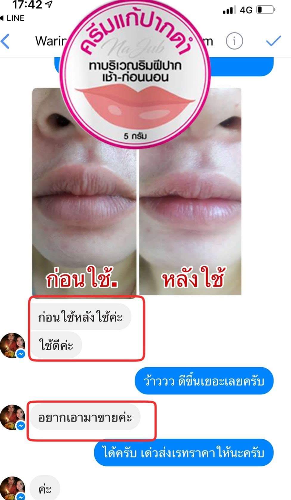 ครีมแก้ปากดำ คลินิค ลิปแก้ปากดำ