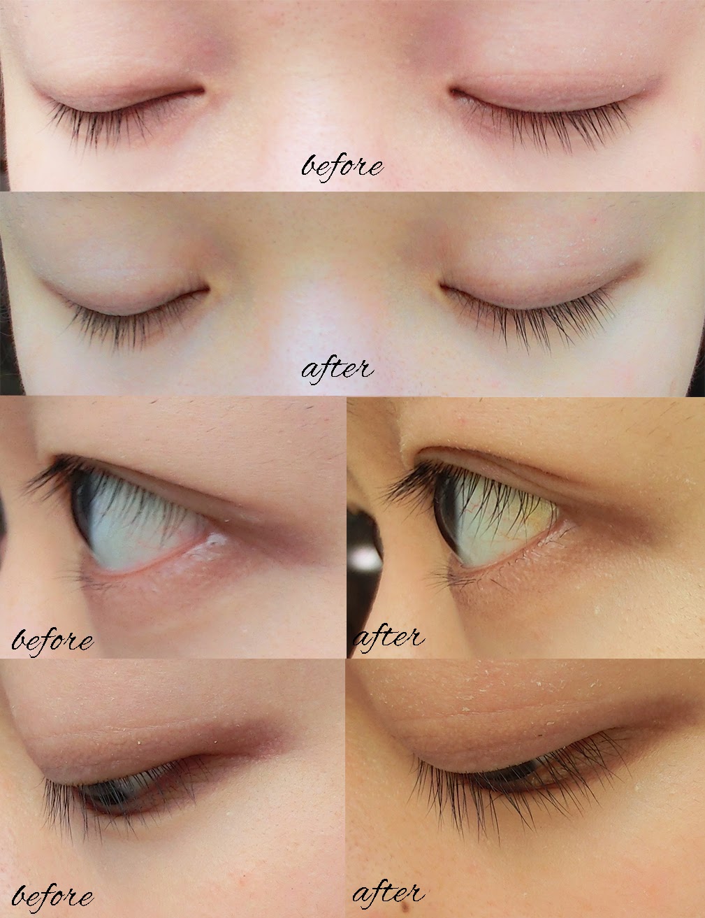 Shiseido Adenovital Eyelash Serum 6g เซรั่มบำรุงขนตา ให้ขนตายาว และแข็งแรง ไม่หลุดร่วงง่าย และบำรุงให้ขนตาที่หลุดมีการขึ้นใหม่อย่างต่อเนื่อง