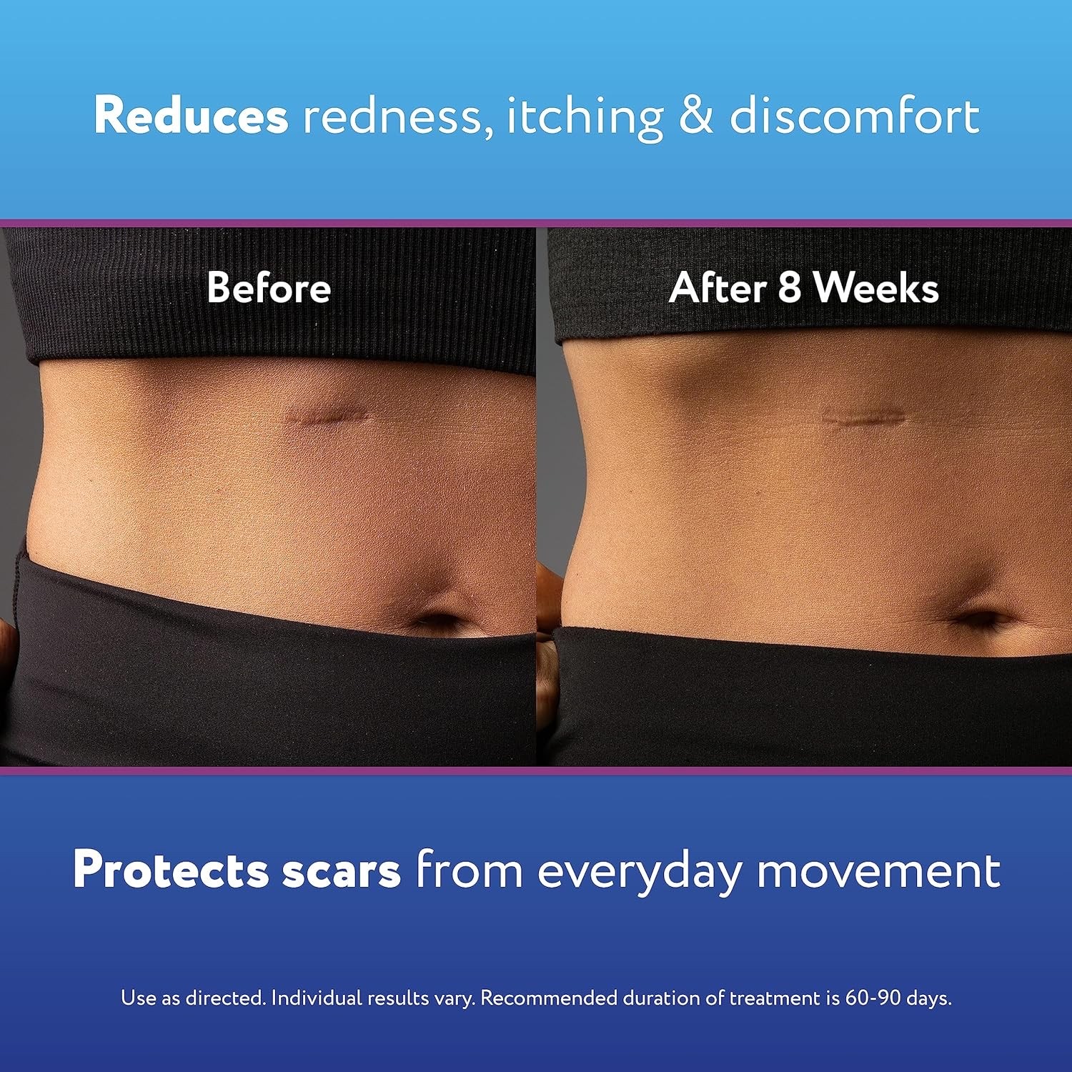 เจลซิลิโคนลดรอยแผลเป็น ScarAway Silicone Scar Gel (10g)