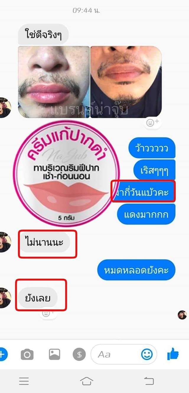 ครีมแก้ปากดำ คลินิค ลิปแก้ปากดำ