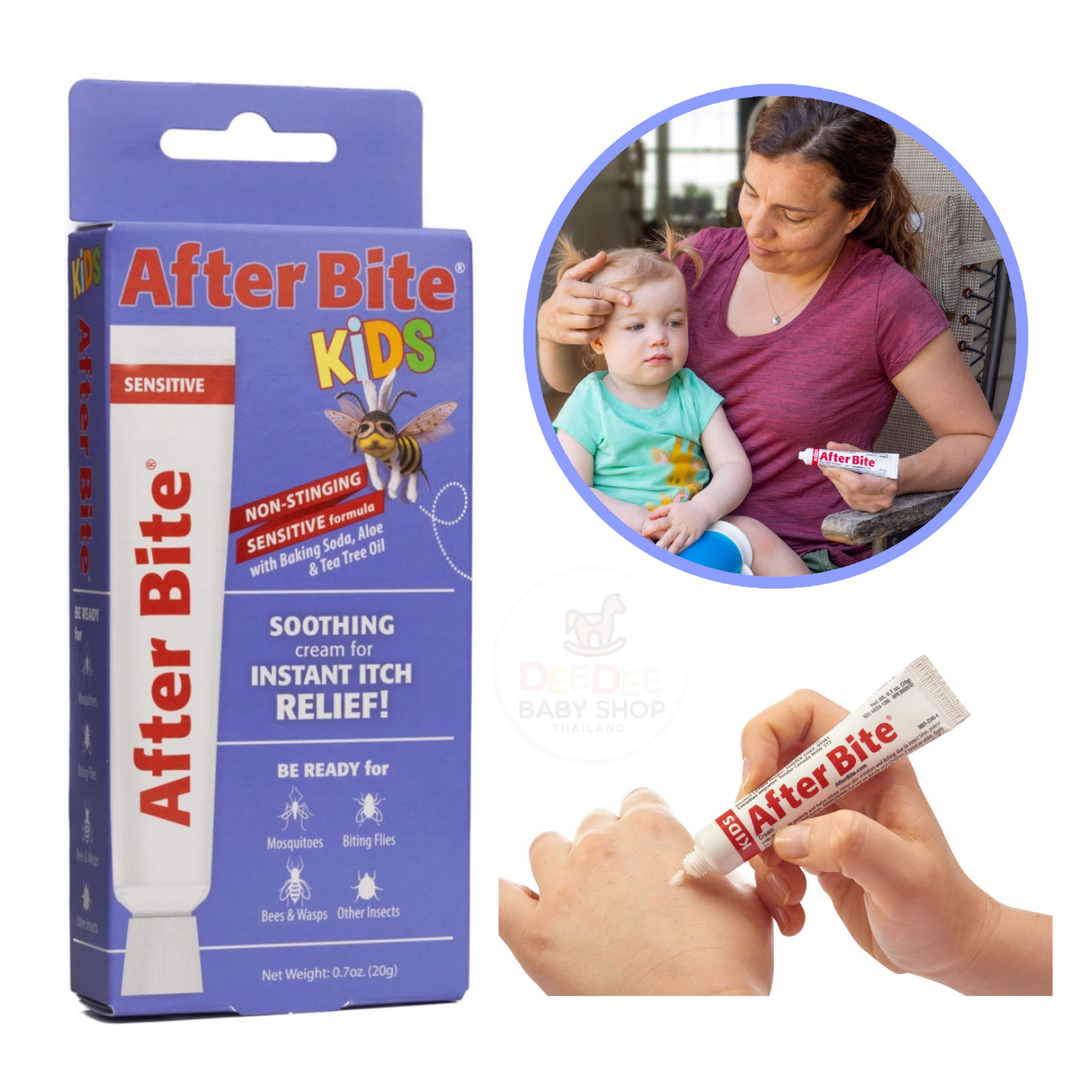 ครีมบรรเทาอาการคันจากแมลงกัดต่อยสำหรับเด็ก After Bite Kids Soothing Cream for Instant Itch Relief