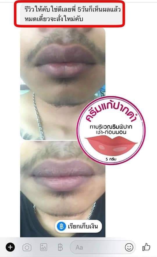 ครีมแก้ปากดำ คลินิค ลิปแก้ปากดำ