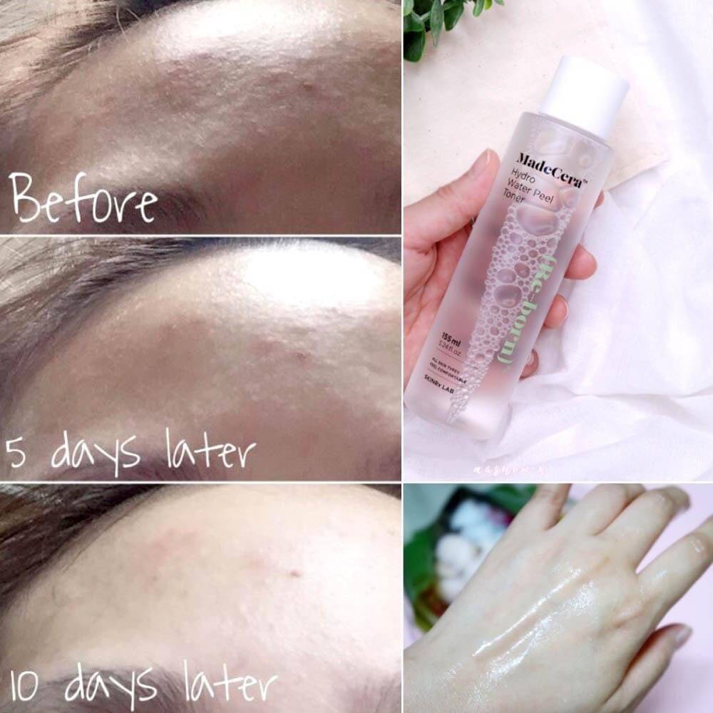 Skinrx MadeCera Hydro Water Peel Toner 155mL โทนเนอร์หน้าเงา Re-born ตัวใหม่ล่าสุดสำหรับผู้มีปัญหา หน้ามัน รูขุมขนกว้าง ผิวลอกเป็นขุย ขาดความชุ่มชื้นใต้ผิว