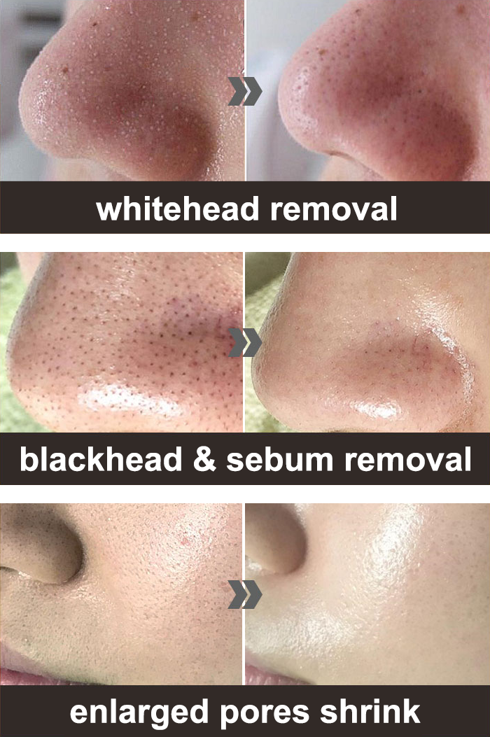 Medi-Peel Black Honey Sebum Extractor 100mL เมดิพีล เซรั่มน้ำผึ้งดำกระชับรูขุมขน สำหรับผิวมันและผิวผสม ด้วยสารสกัดจากน้ำผึ้งดำของออสเตรเลีย Manuk ซึ่งช่วยเปิดรูขุมขนและขจัดไขมันส่วนเกินที่สะสม