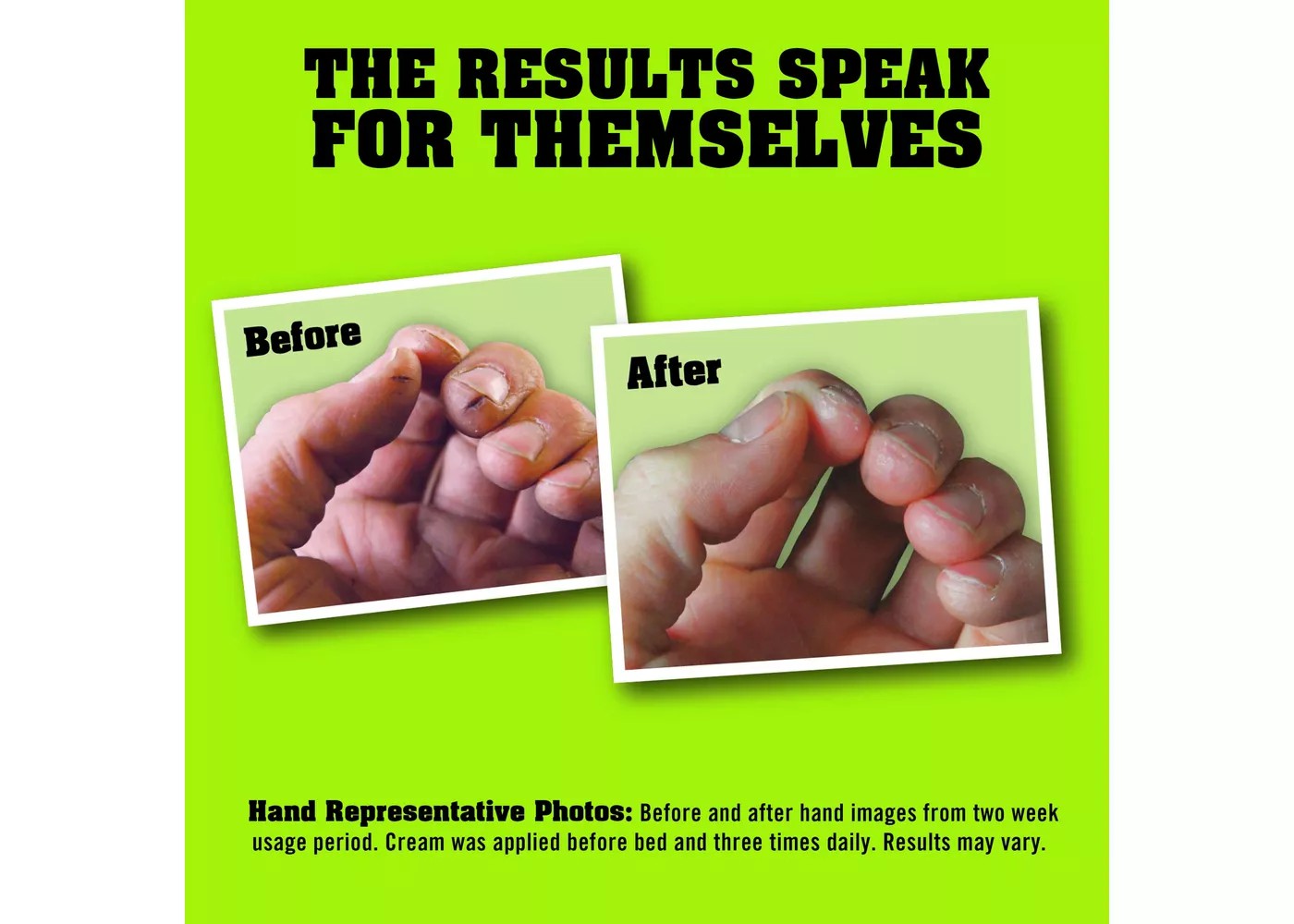 ครีมบำรุงผิวสำหรับมือ เล็บ และนิ้วชนิดเข้มข้น O'KEEFFE'S For WORKING HANDS Hand Cream