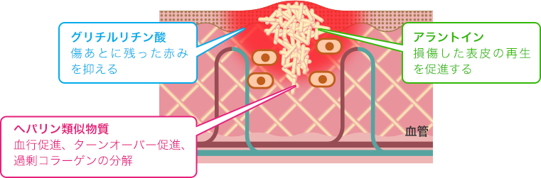 (กล่องชมพูน้ำเงิน) Kobayashi Attonon Scar Gel Ex 15g เจลทาลบรอยแผลเป็นคีลอยด์ แผลนูน แผลตะขาบ รอยผ่าตัด แผลนูนแดง อักเสบ