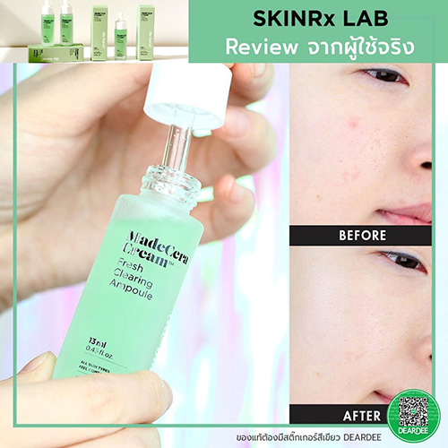 (ขวดเขียว) SKINRx LAB MadeCera Cream Fresh Clearing Ampoule 13mL เซรั่มบำรุงผิวหน้า ซึมไว ไม่เหนอะหนะ