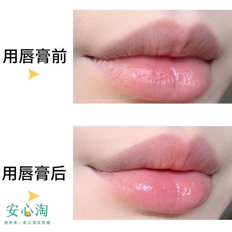 (แพคคู่) Mentholatum Medicated Lip Stick XD ลิปบาล์มยอดนิยมจากญี่ปุ่น สูตร Quick Relief คือบรรเทาอาการแห้งแตกอย่างเร่งด่วน พร้อมฟื้นฟูให้ความชุ่มชื้นกับริมผีปาก ใช้ต่อเนื่องให้ความเรียบเนียนทาลิปติดทน