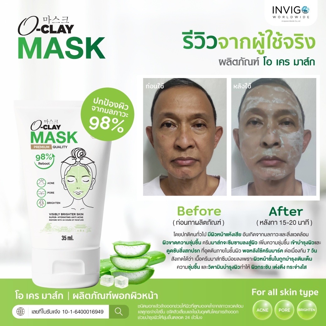 Oclay Mask โอ เคลย์ มาส์ก สิวอักเสบ รูขุมขน ผิวหน้า ผิวขาว สว่าง กระจ่างใส อืนวิโก้ Invigo