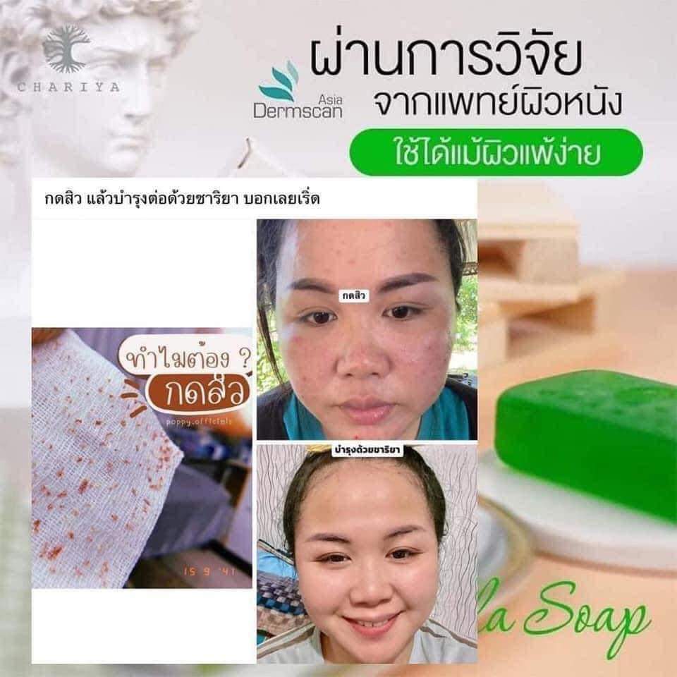 สบู่ใบบัวบก ชาริยา ของแท้ 100% แถม!! ต่าข่ายตีฟอง ฟรีเก็บเงินปลายทาง